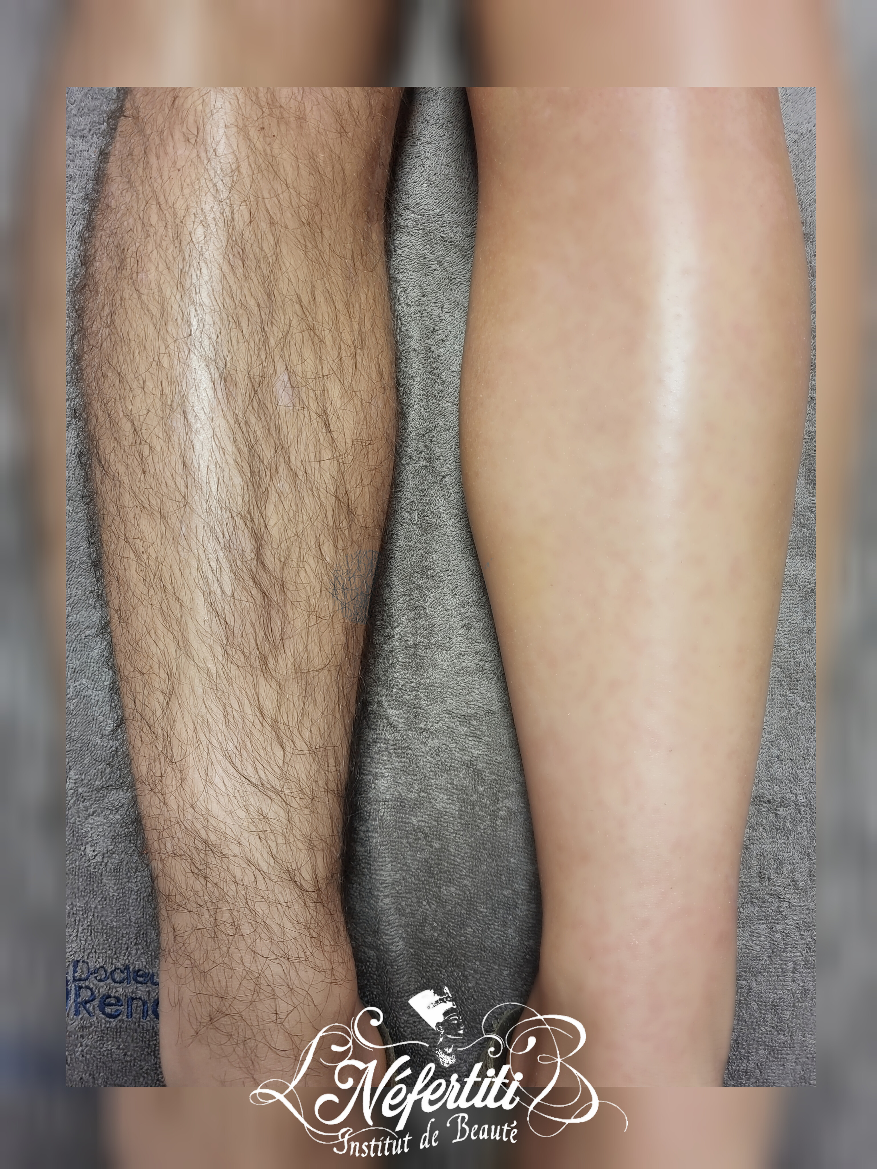 Photo de la catégorie EPILATION FEMME