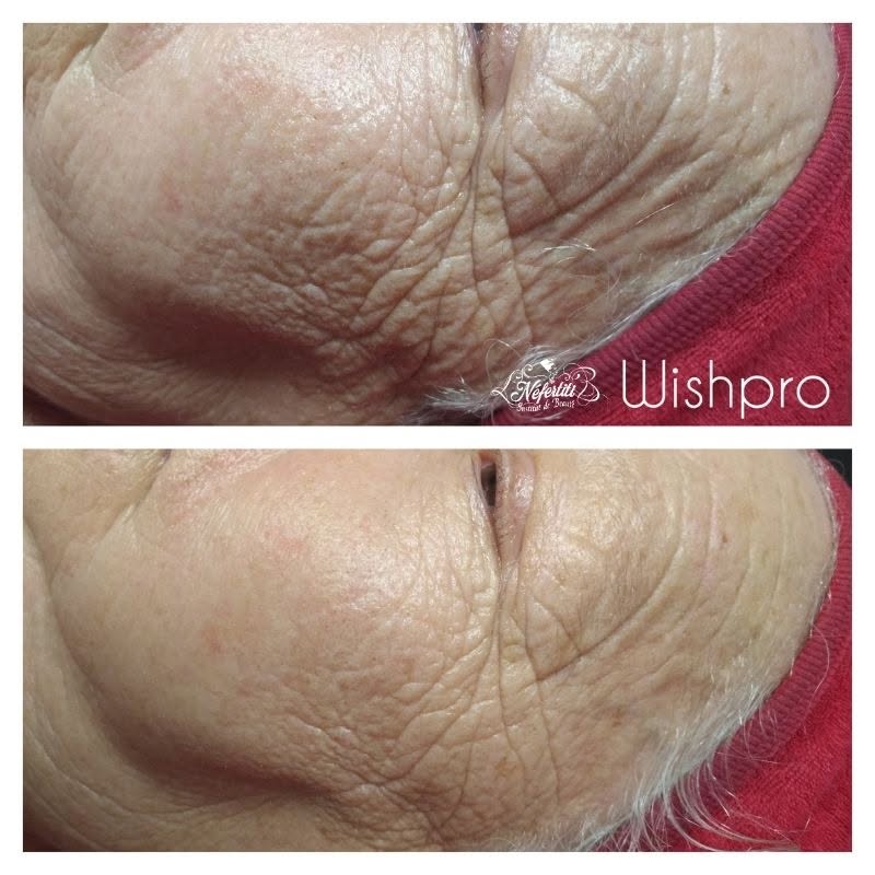 Wishpro 1 séance