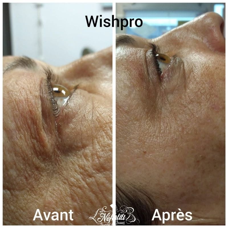 Whispro 1 séance
