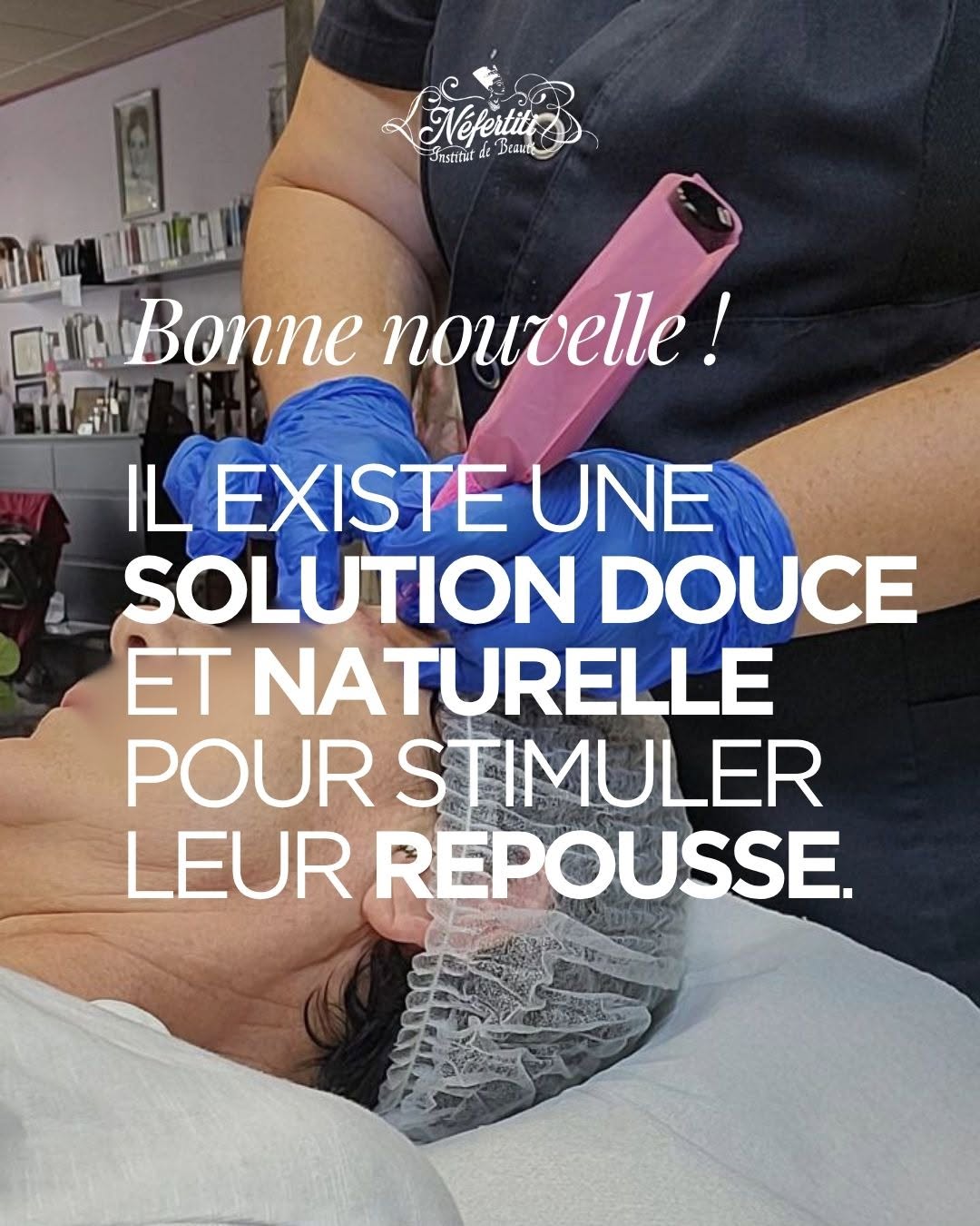 Technique par micro stimulation