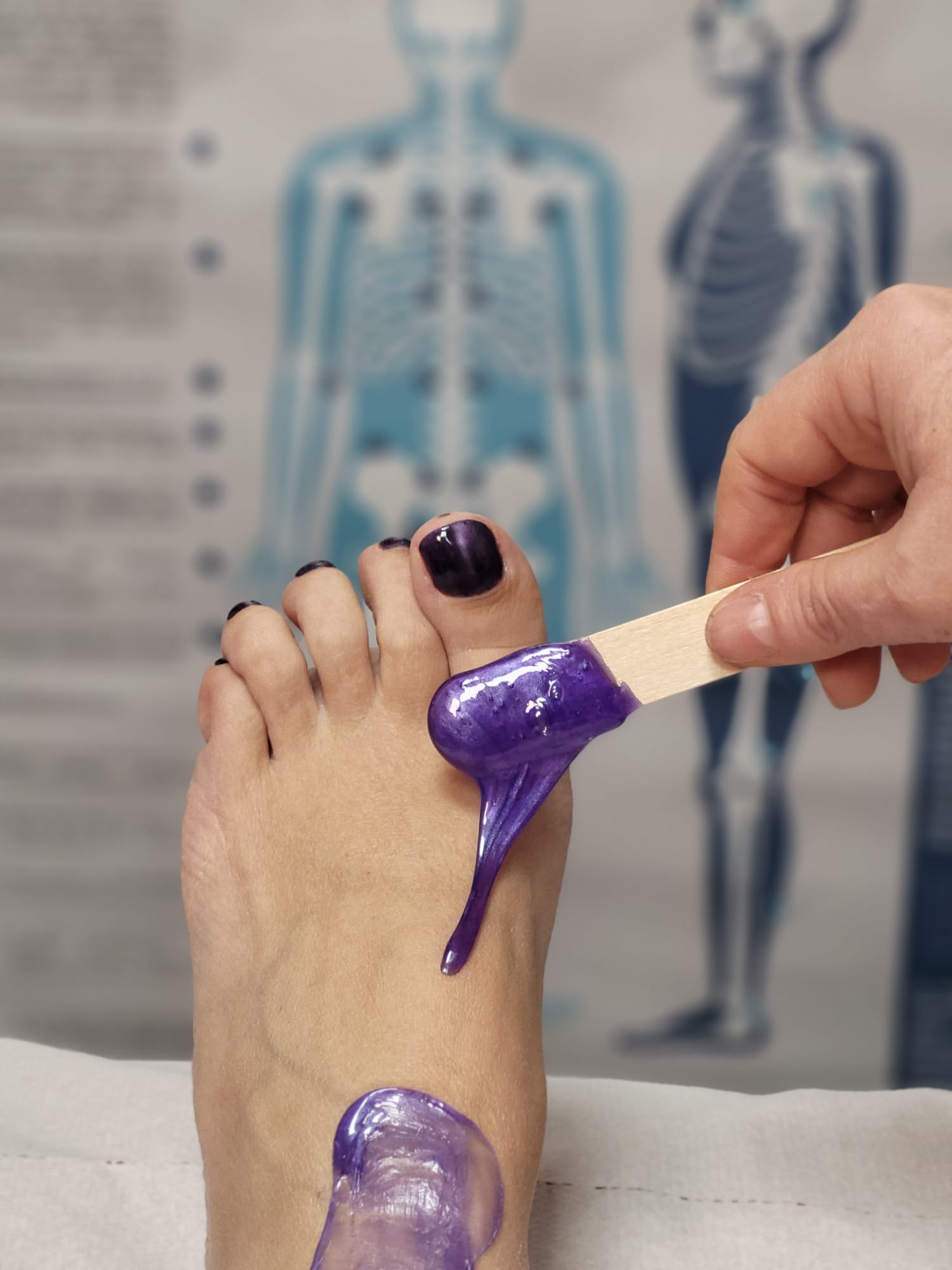 Voir les photos : EPILATION FEMME