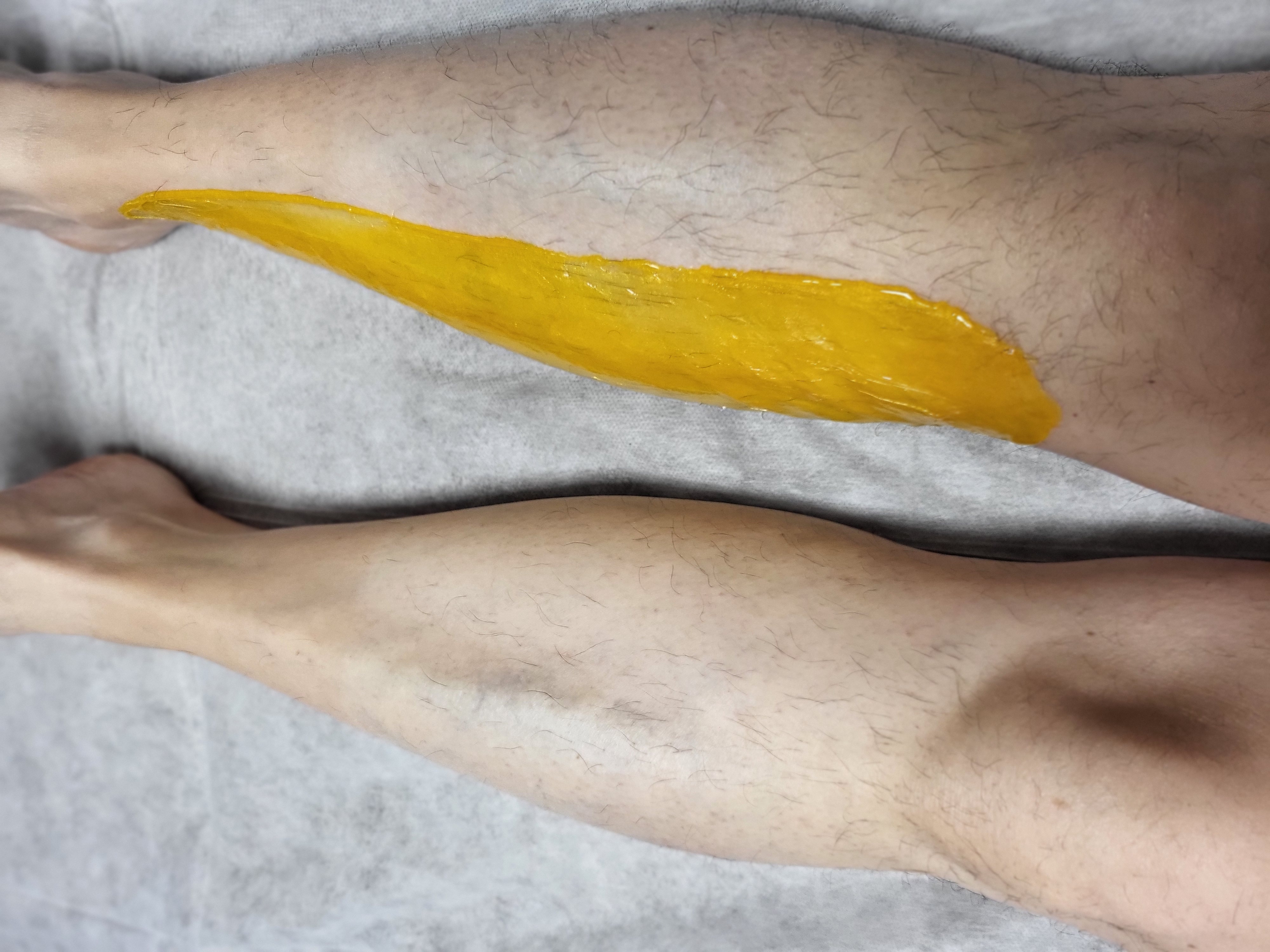 Voir les photos : EPILATION HOMME
