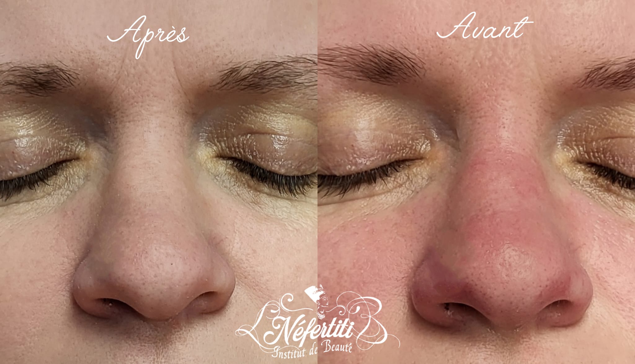 Voir les photos : SOINS DU VISAGE