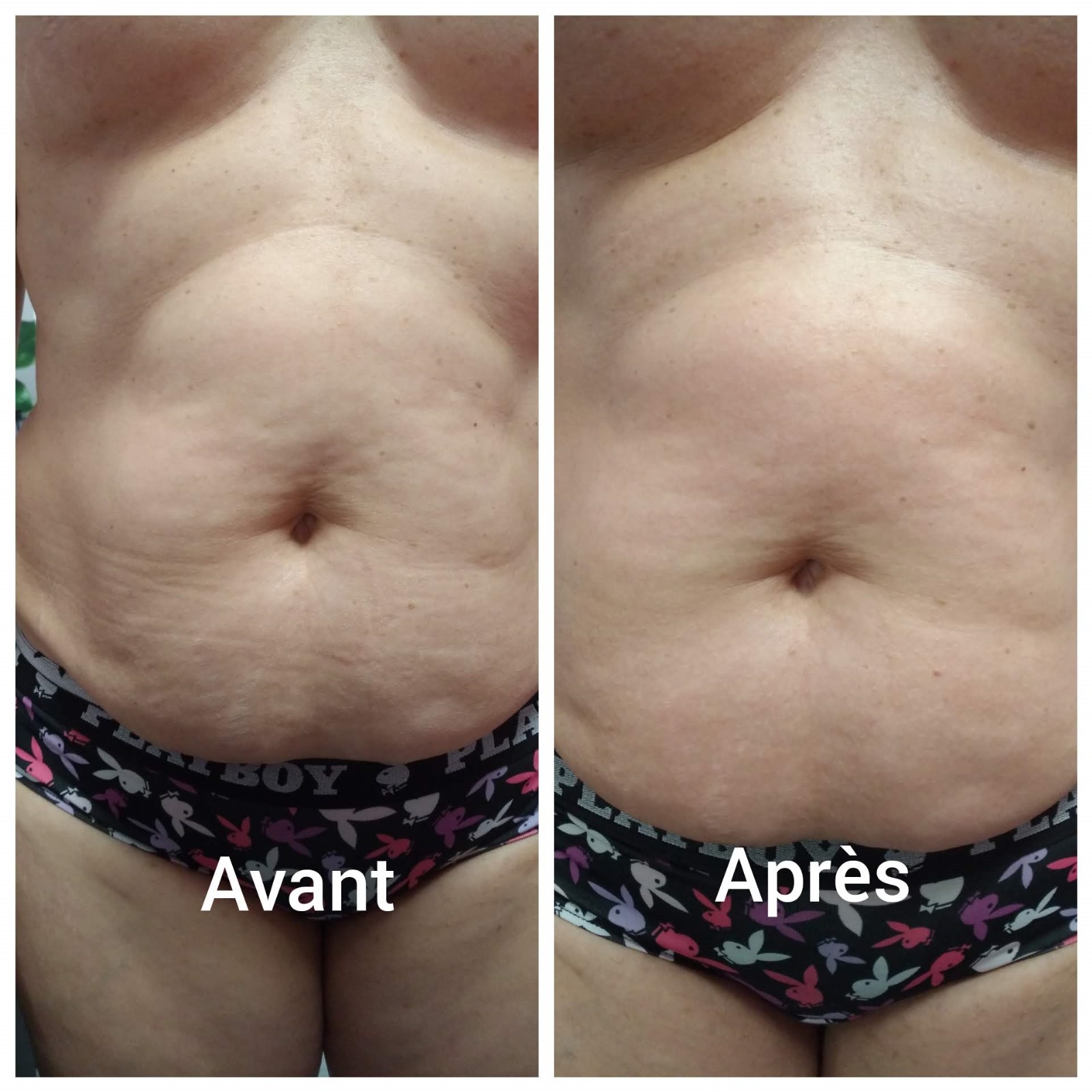Photo de la catégorie MASSAGES SPECIFIQUES