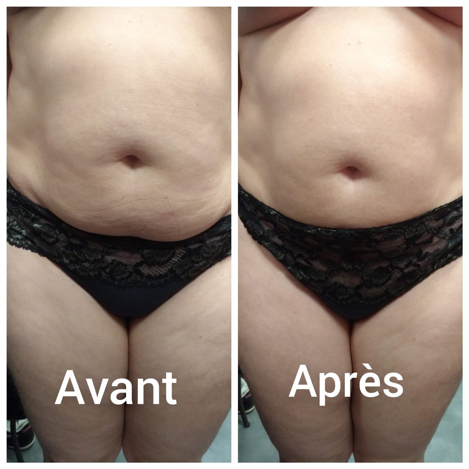 Photo de la catégorie MASSAGES SPECIFIQUES